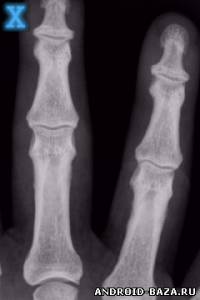 X-Ray Scanner — Рентген скриншот 3